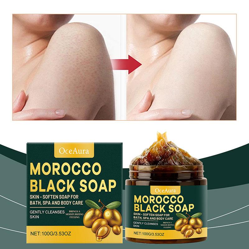 モロッコ産ブラックソープ　ディープクレンジング　ジェントルケ - Castor Oil Soap のレビューと価格